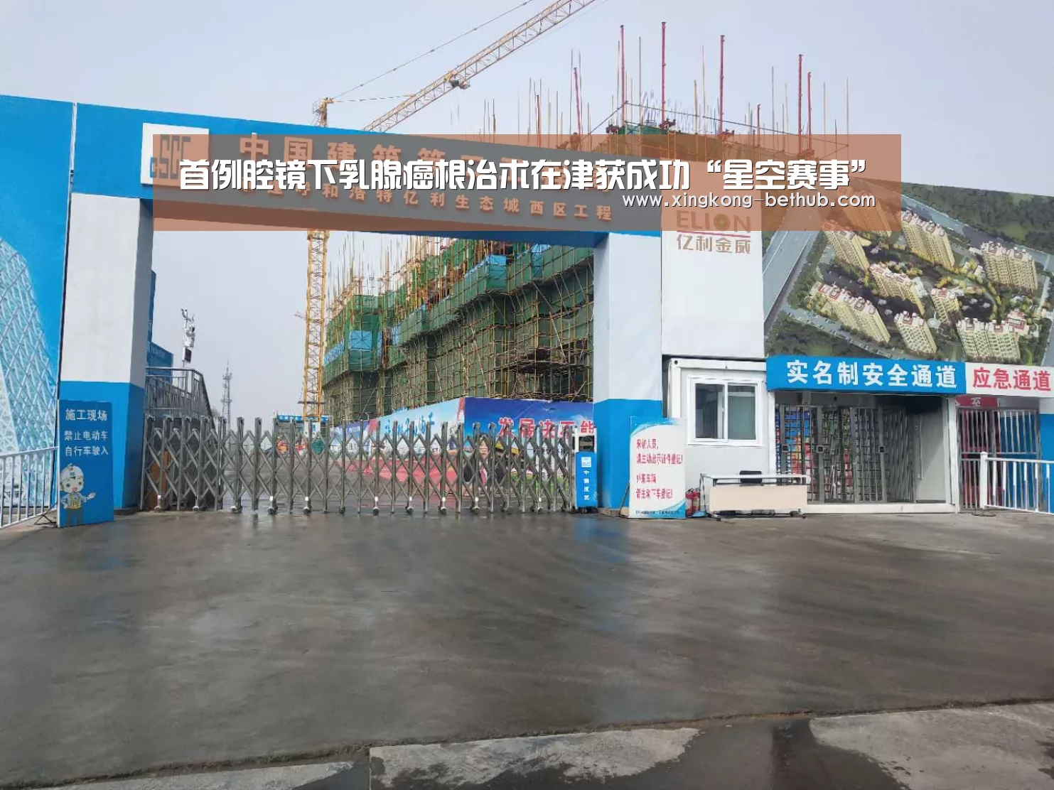 首例腔镜下乳腺癌根治术在津获成功“星空赛事”(图4) 星空赛事